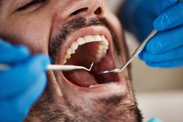 Professional Emergency Dental Service in FL