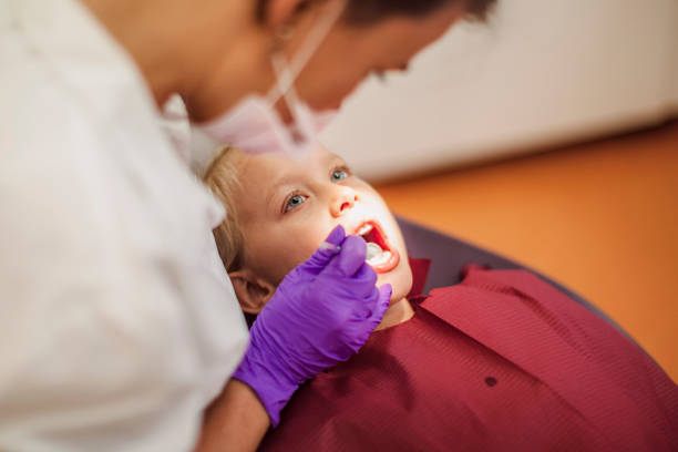 Best Knocked-Out Tooth (Avulsed Tooth) Treatment in Pinellas Park, FL